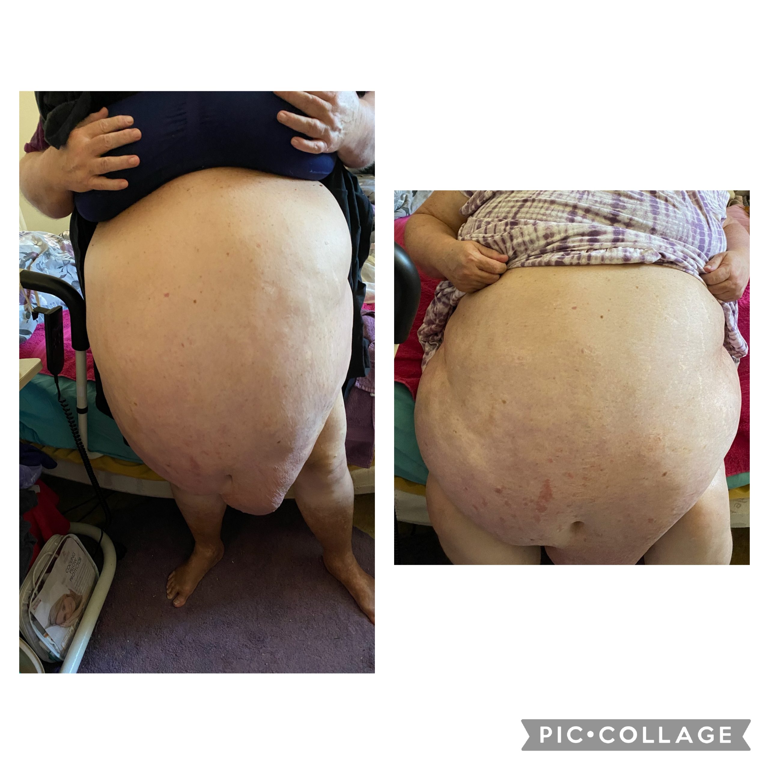 Amazing before and after abdomen